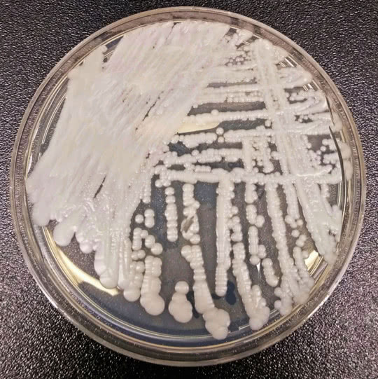 多重抗药性的耳念珠菌